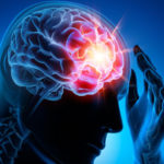 What is the Law on Driving while suffering from Epilepsy